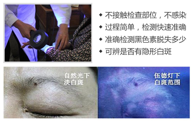 兰州白癜风医院最新动态一览