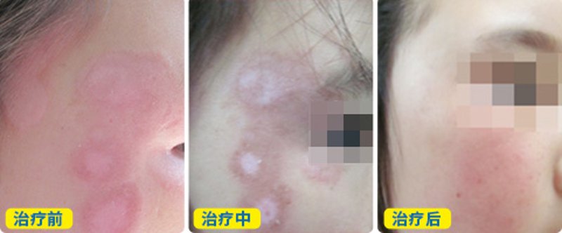兰州治疗白癜风医院现状观察与思考